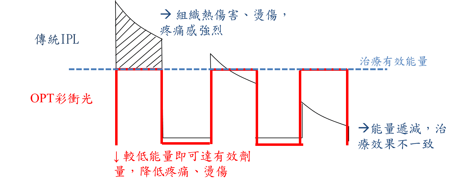 M22_彩衝光雷射_lumenis_價格_費用_禁忌_多少_評價_PTT_dcard_推薦_原理_脈衝光_差異