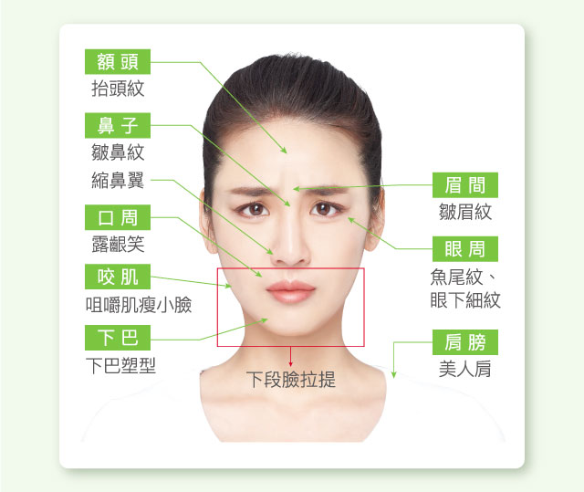 英國_皇家_肉毒_DYSPORT_適應症_施打部位_額頭_鼻子_口周_眉間_眼周_肩膀_咬肌_下巴_小腿