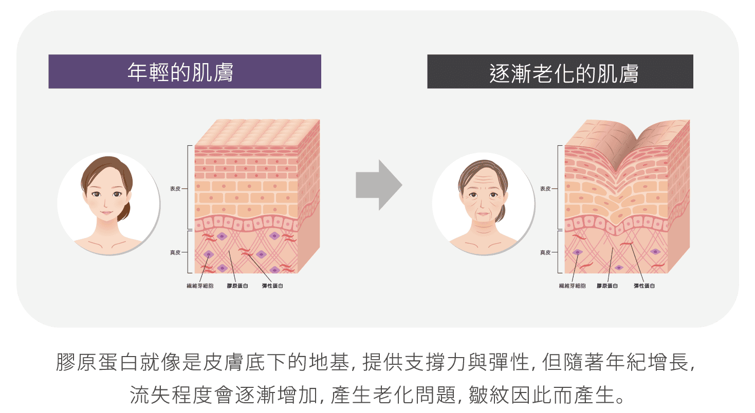 Oligio_玩美電波_肌膚老化原因