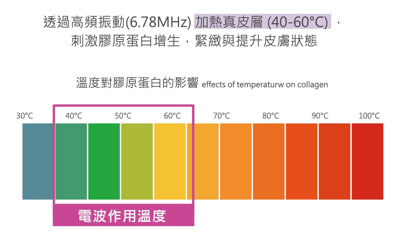 Oligio_玩美電波_單極電波_元晨診所_台北_板橋_台中_忠孝復興_中山_府中_勤美