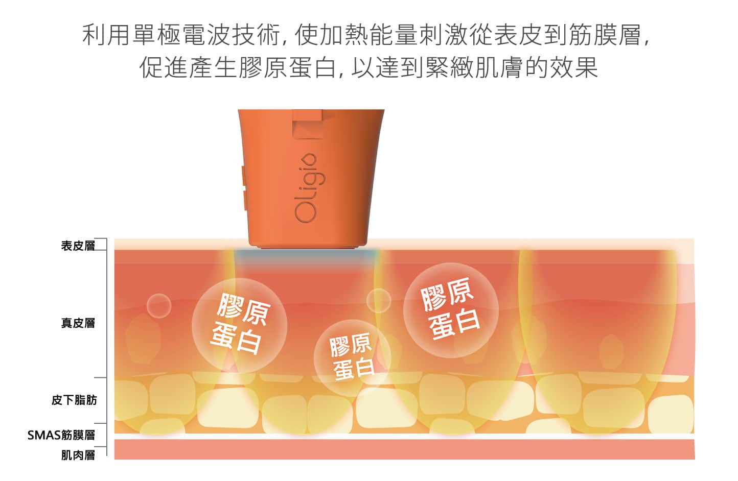 Oligio_玩美電波_由內而外緊緻除皺